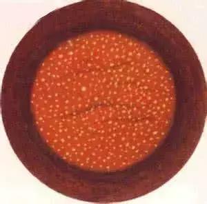 眼前一直有蚊子是什么病,眼前总有蚊子飞怎么治呀