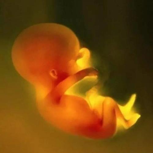 胎儿肾积水还能要吗,孕37周肾积水影响顺产或剖腹产吗