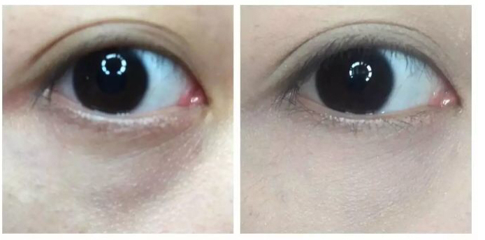 张馨予超爱的品牌！99元的眼霜，就能改善黑眼圈、干纹！