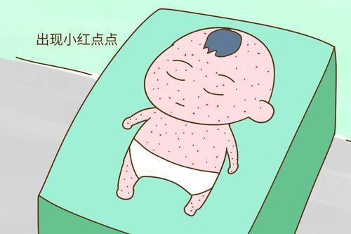 幼儿急疹出疹后怎么缓解瘙痒,幼儿急疹刚出疹后怎么护理