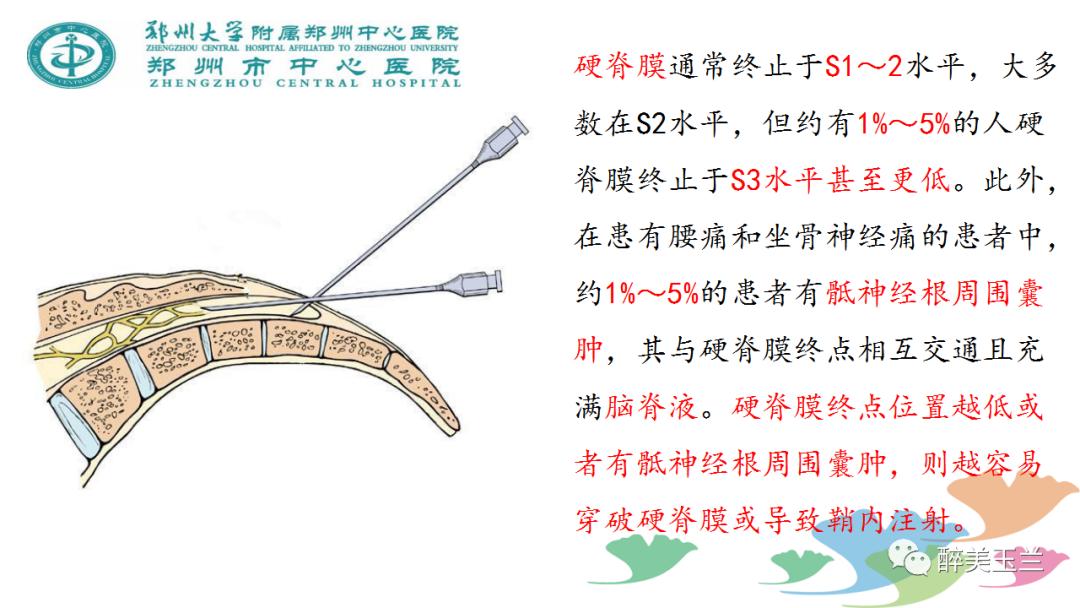 局麻药中毒的术前用药口诀,局麻药中毒临床表现及处理流程ppt