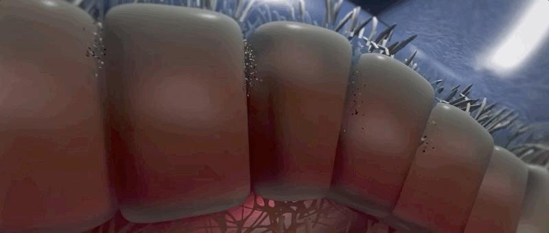 哮喘过敏症的症状,呼吸道过敏哮喘症状