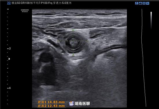 宝宝半夜腹痛呕吐什么原因,宝宝哭闹恶心干呕怎么回事