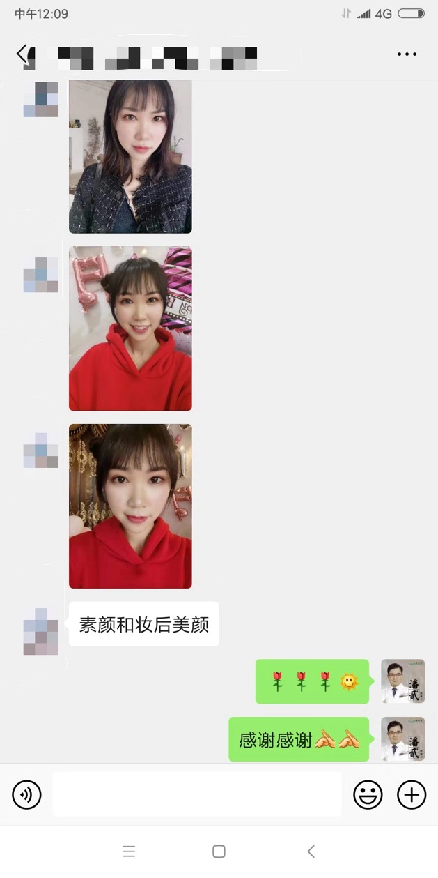 开内眼角会留疤的照片,开内眼角的疤痕变白色了怎么办