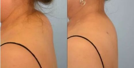 为什么富贵包变夺命包,富贵包是夺命包吗