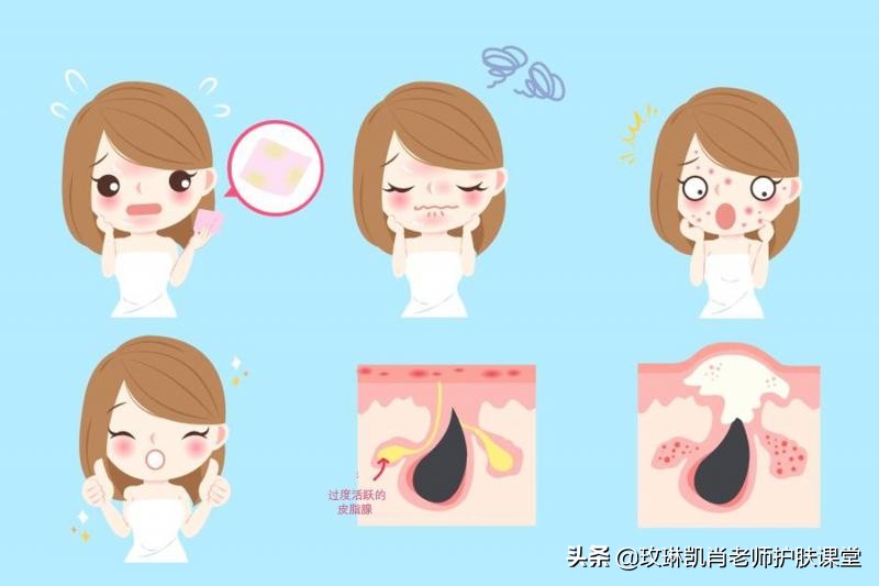 额头脸颊下巴长痘怎么调理,额头脸颊下巴反复长痘如何调理