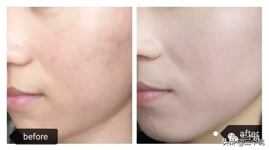 口碑最好十大粉底液夏季,十大公认好用的粉底液及价格