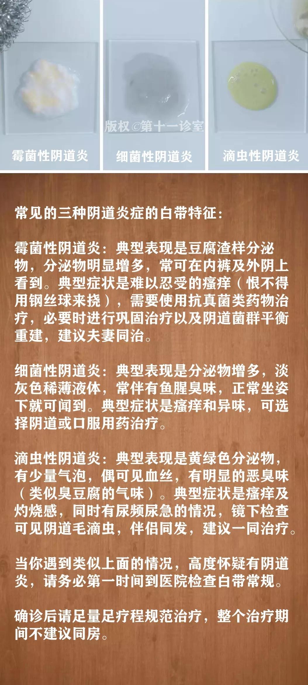 女人妇科白带的知识,女生白带冷知识