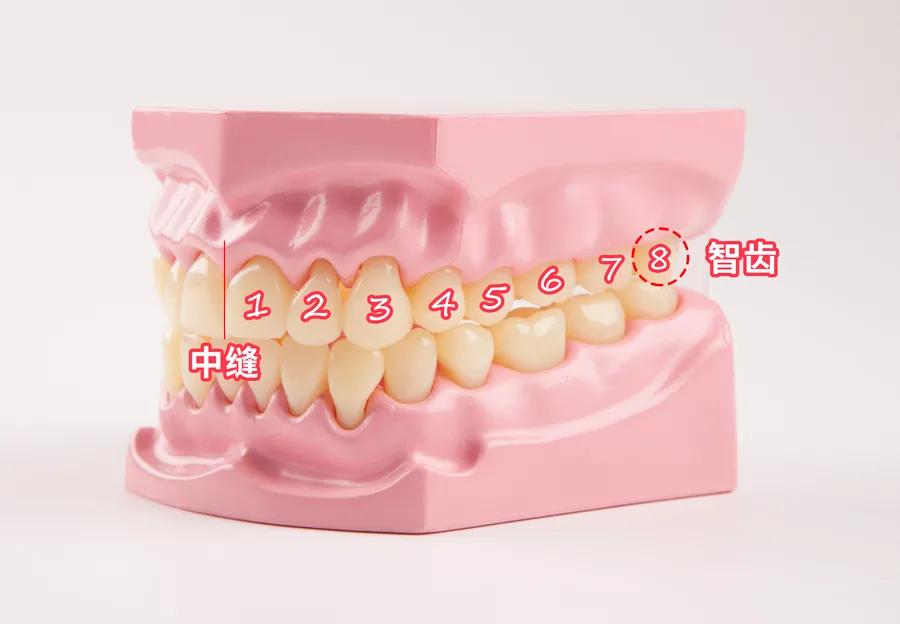 有没有智齿不拔的案例,我有个智齿没长出来怎么拔