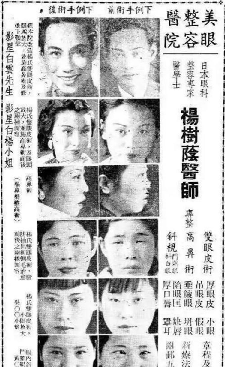 世界第一例整容手术如何诞生的,世界上最早出现的整形医院