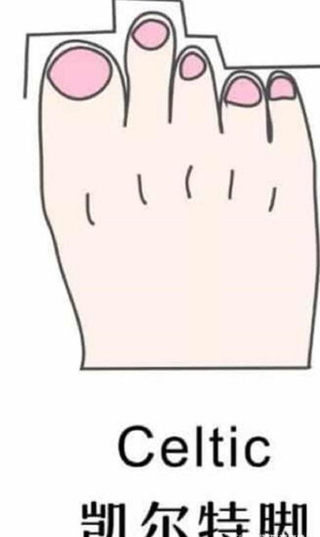 女性脚型有哪几种,女性脚型有哪些