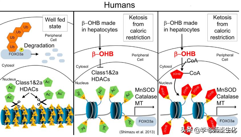 酮体代谢及酮体的多种生理功能,什么是酮体酮体有什么生理意义