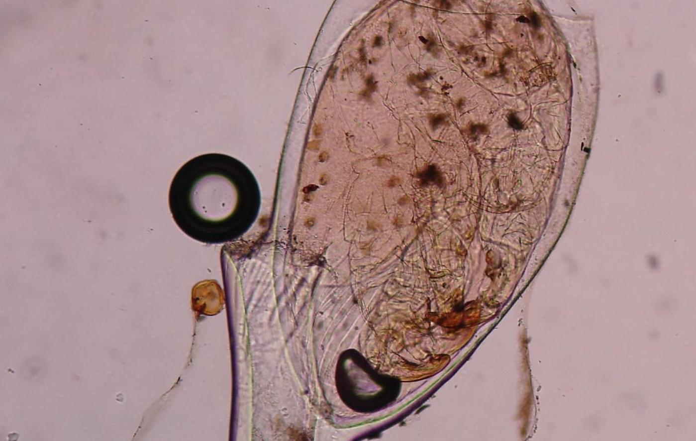 30年前人人身上都有的虱子,30年前人人都有虱子为啥现在消失