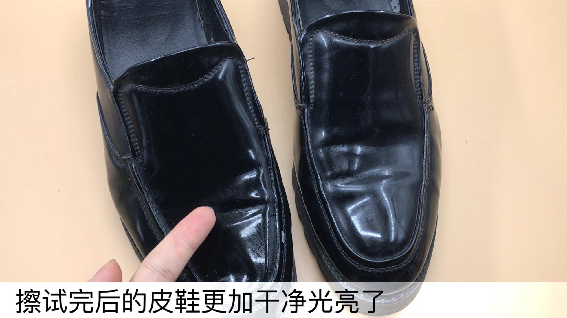 香蕉皮太厉害了，好多人的难题全都解决了，看完赶紧告诉家里人