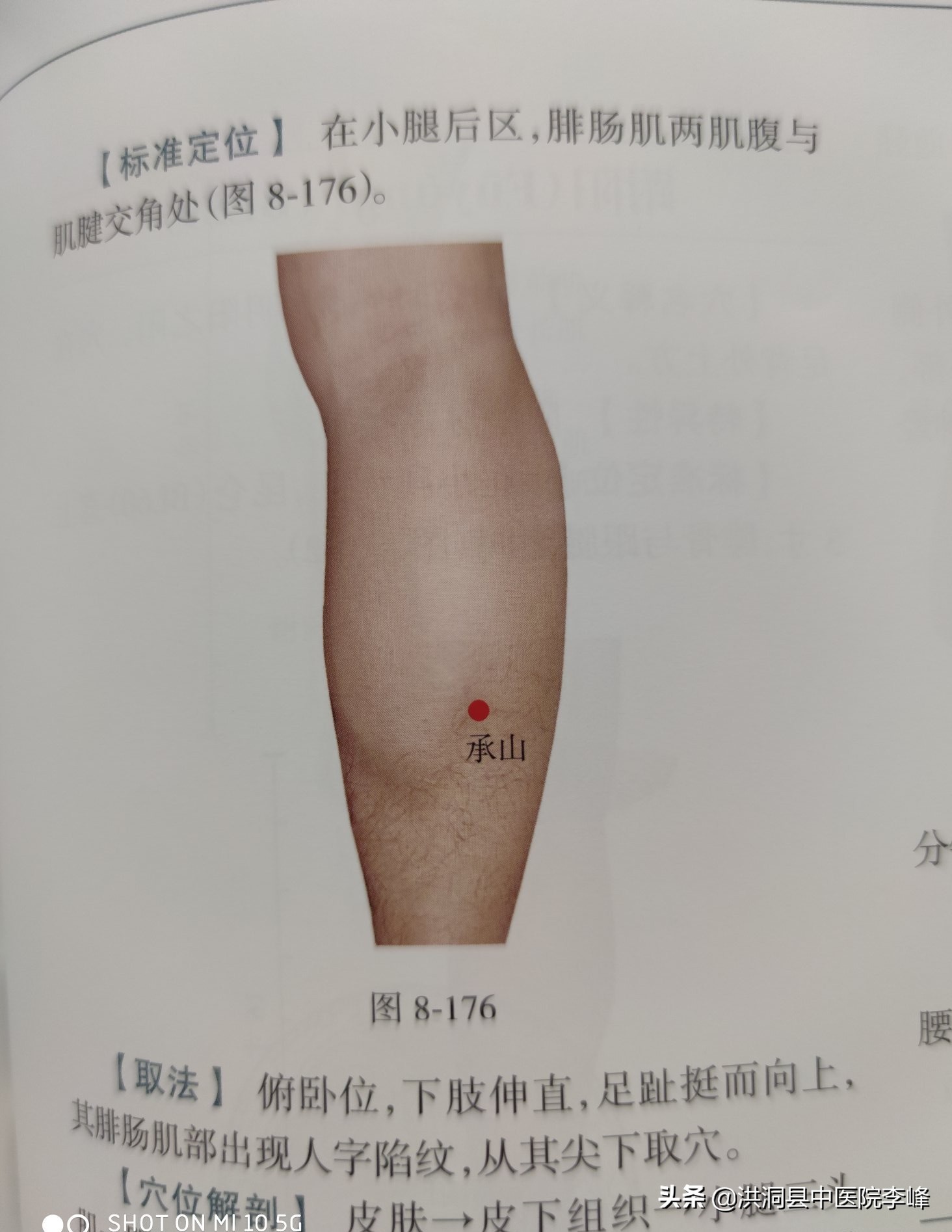 常见痛症“针刺运动疗法”特定取穴