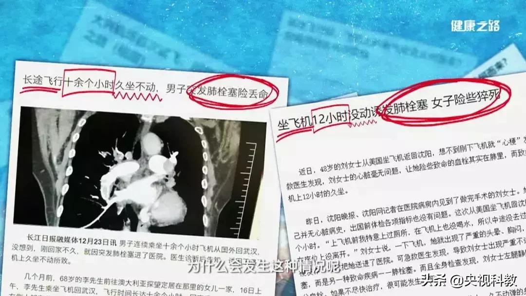 这4类人需尤其当心,肺栓塞会猝死吗