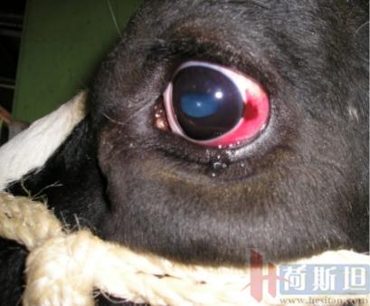 产后急性子宫内膜炎,产后急性宫颈炎症状