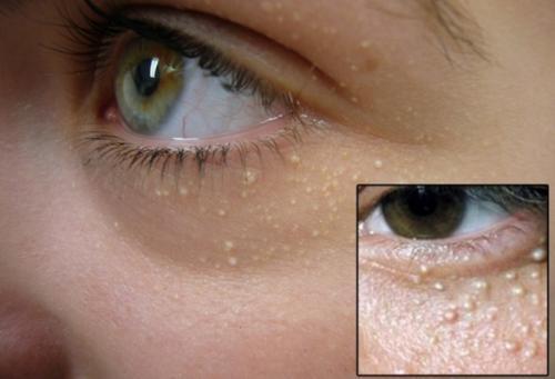 眼霜换着用会影响效果吗,眼霜涂了为什么还长细纹