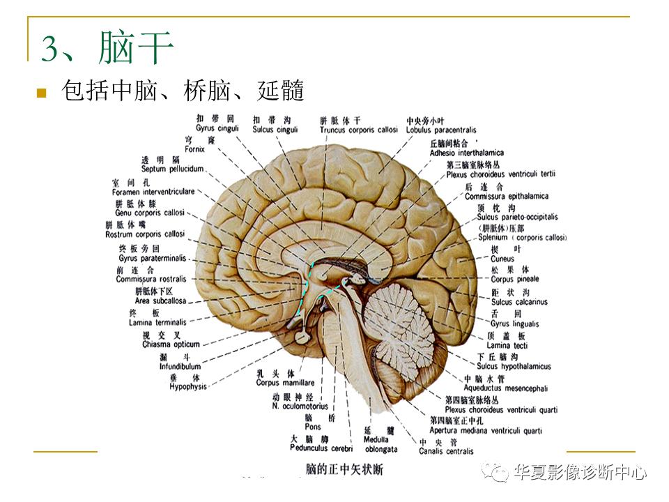 中国人脑立体定向mri应用解剖图谱,脑mri示意图
