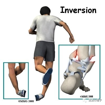 习惯性崴脚后康复训练,习惯性崴脚康复锻炼