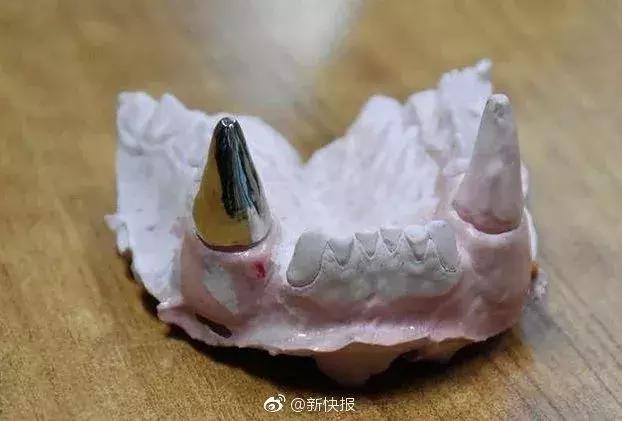 牙根管治疗大熊猫,大熊猫治牙