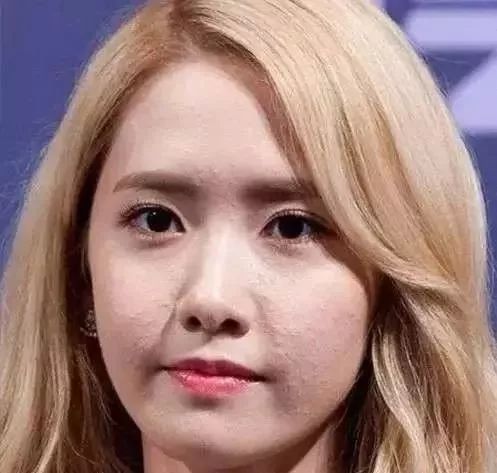 脸上长闭口怎么办用什么方法消除,脸上长闭口该怎么消除