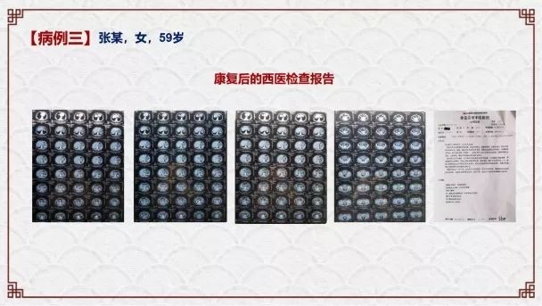 肿瘤与糖尿病——浅谈中医的认识学（诺贝尔奖医学峰会实录）