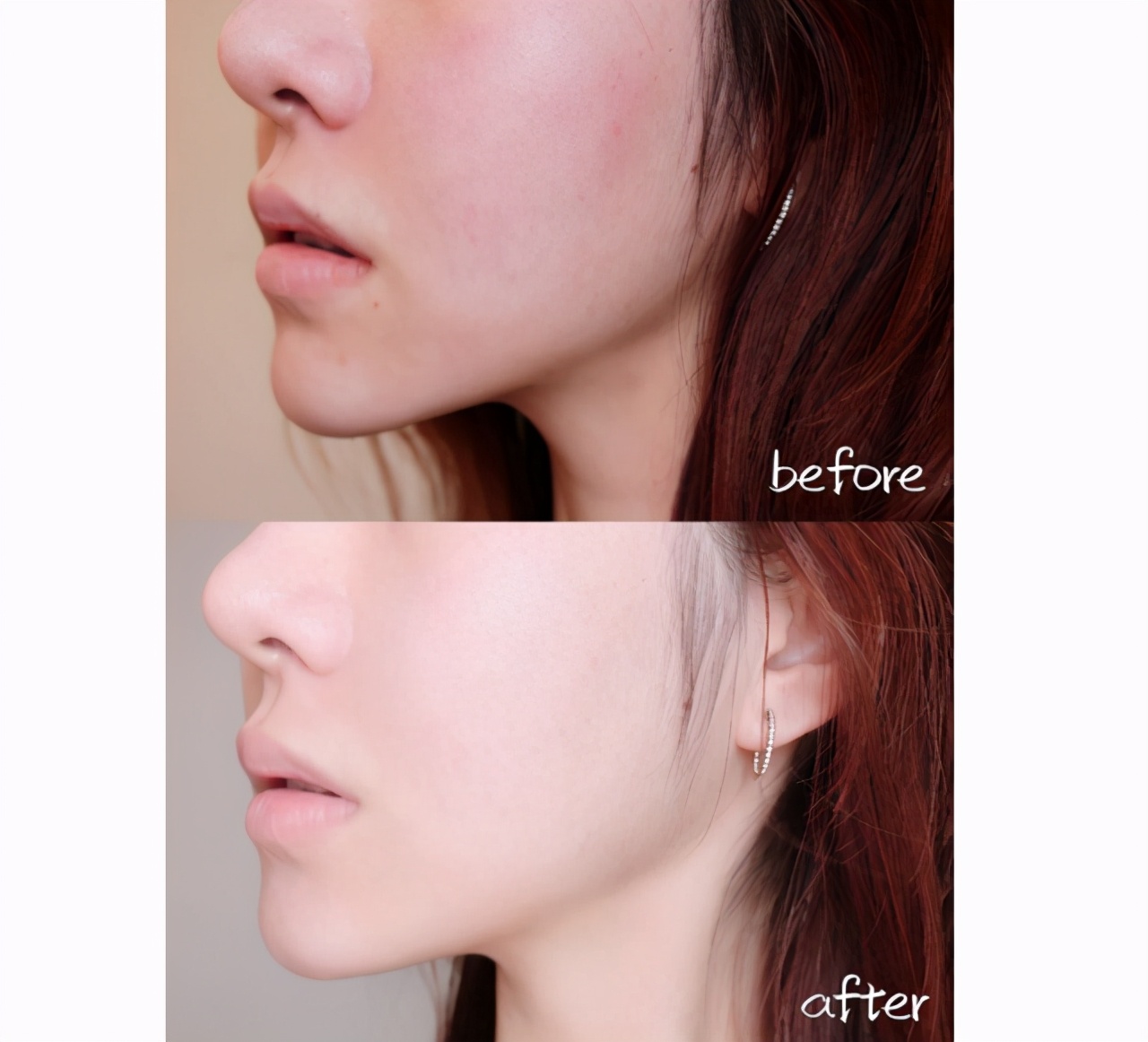 秋天,比第一杯奶茶更重要的是这款神仙贵妇膏,它将释放你的美