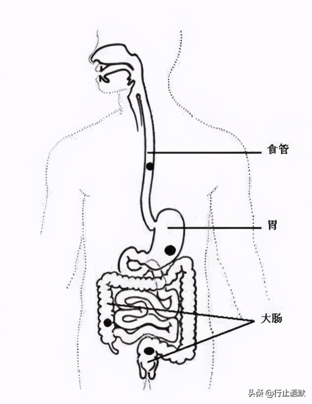国医大师董建华脾胃病治疗经验