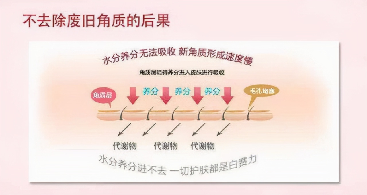 为啥要去脸部角质,为什么要去皮肤上的角质