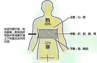 经常上火的中药处方,上火下寒的最佳治疗方法