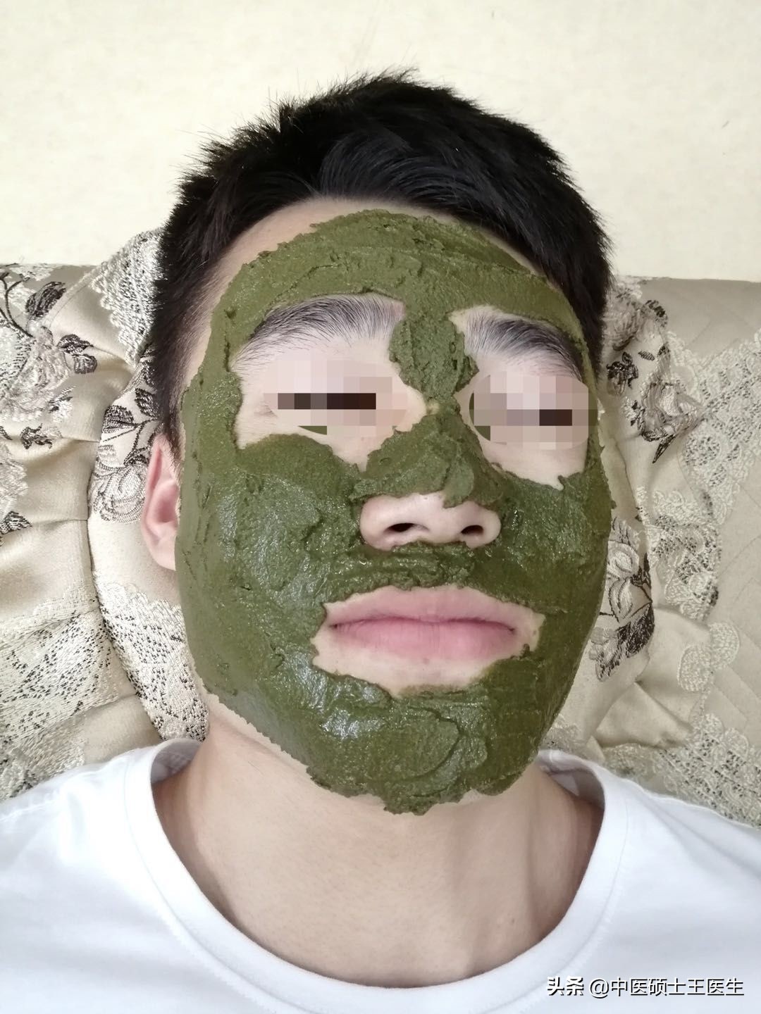 中医祛痘多少钱,中医祛痘挂什么科