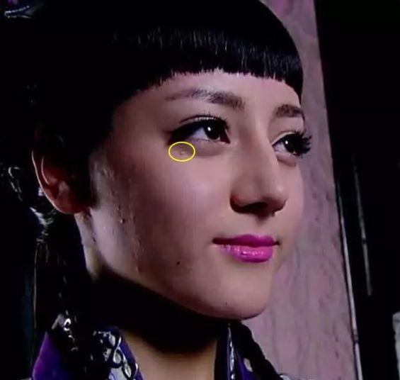 脂肪粒别用针挑教你一个土办法,脂肪粒怎么用针挑出来不疼