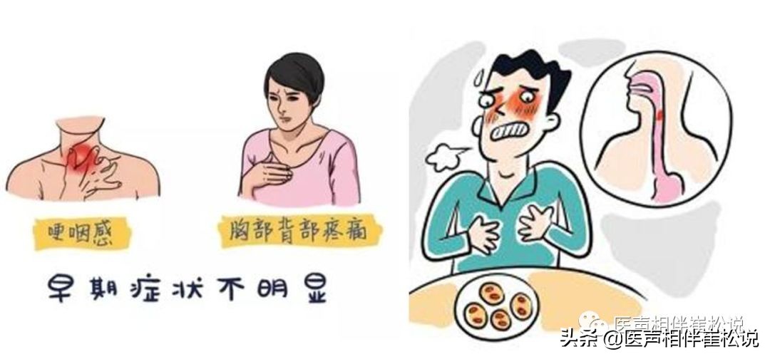 “万恶的”胸痛之七大疾病（上）