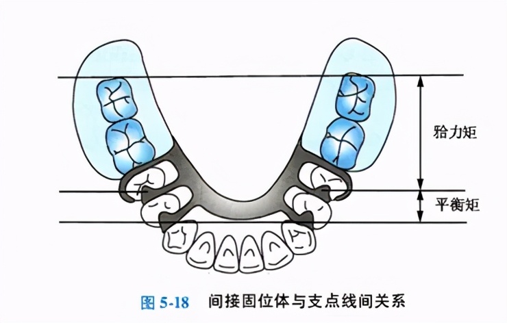 牙列缺损的可摘局部义齿修复题库,牙科美学修复精讲