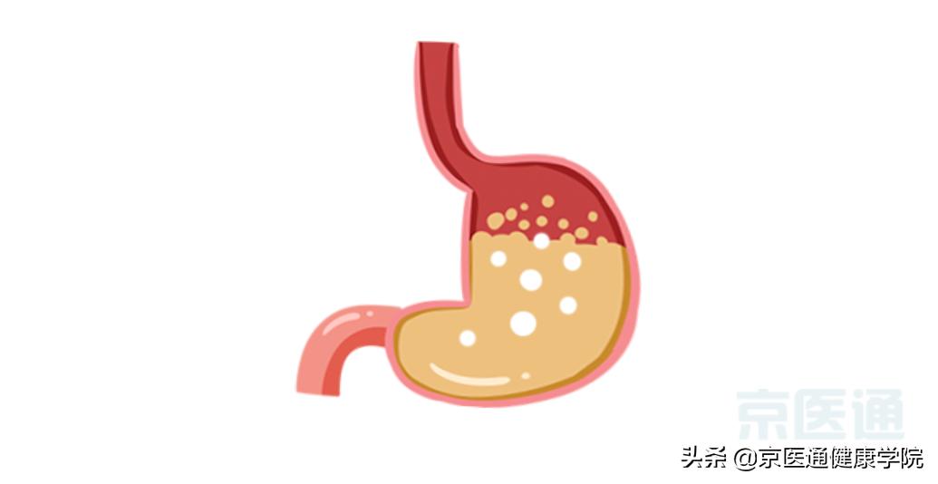 一分钟解决胃肠胀气的方法,胃肠道胀气做什么动作来缓解