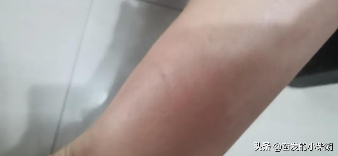 如果遇到红火蚁应该如何自救,红火蚁入侵要小心专家帮你划重点