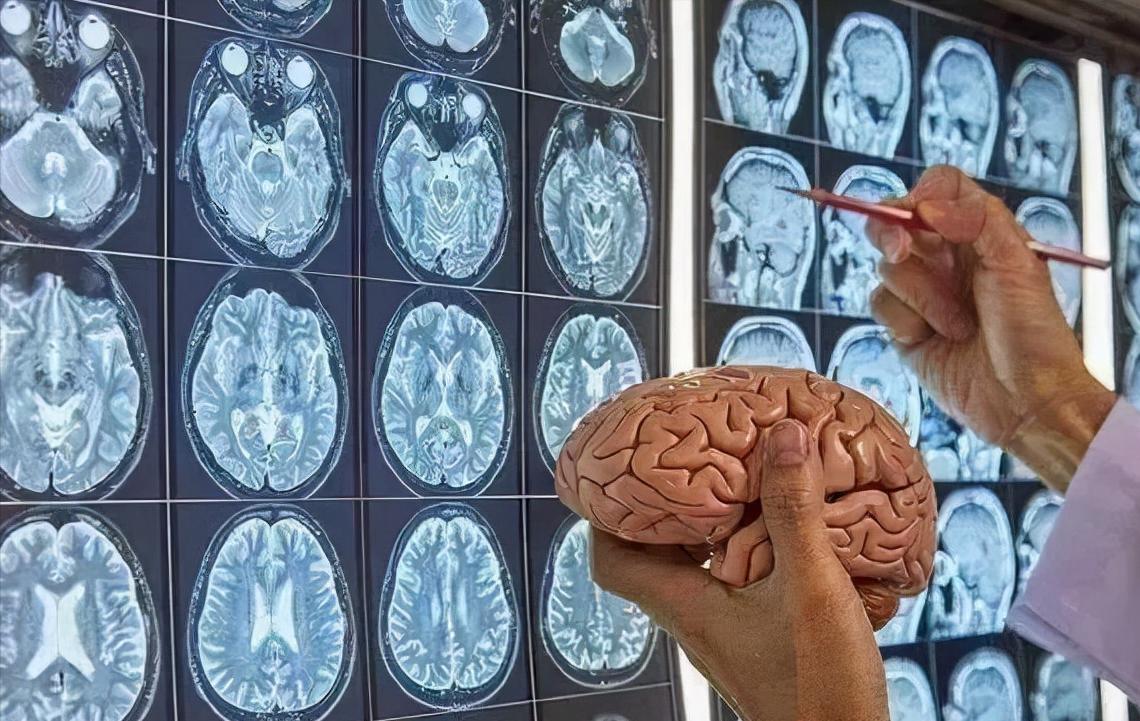 干细胞有望成为神经系统疾病的新一代疗法