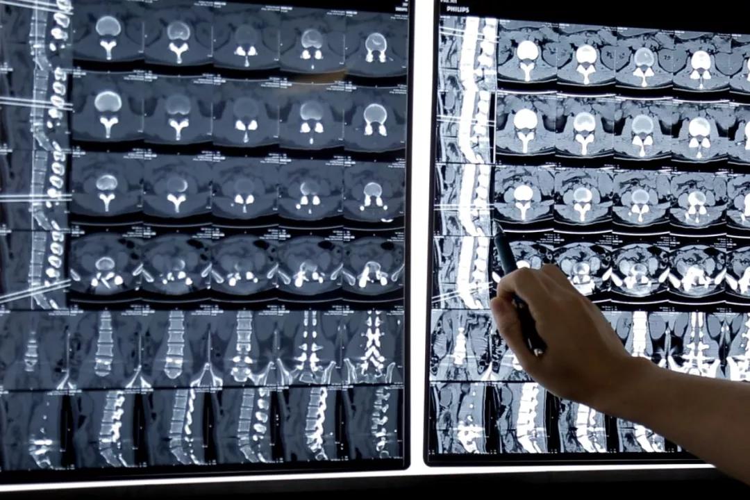 撸串会导致什么病,撸串引起的病症