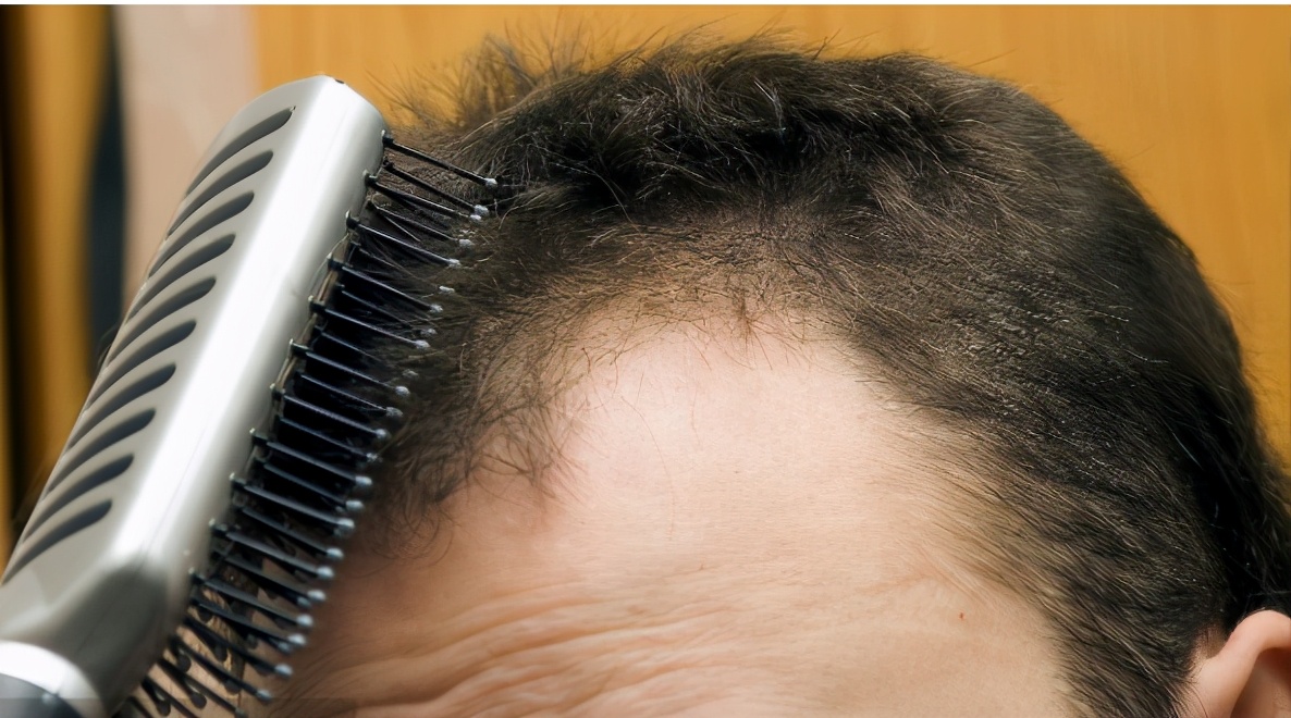 梳子上市公司,上市公司的梳子