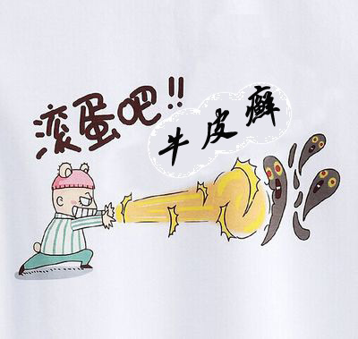 牛皮癣困扰了很多的人,对于牛皮癣你足够了解吗