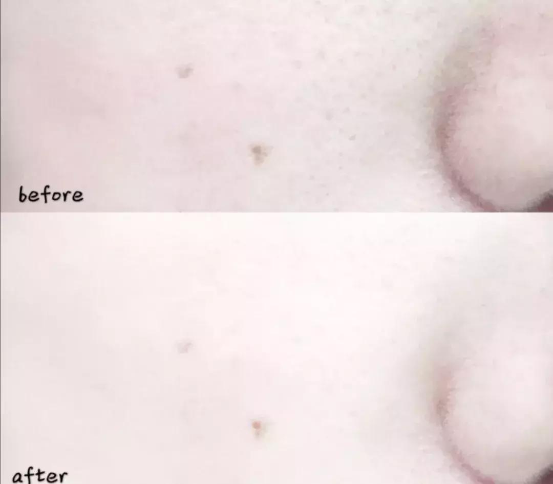 日常这些护肤误区千万不要踩,十大护肤烂脸成分