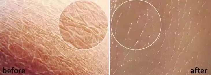 乳木果保暖润肤裤,乳木果磨砂膏去除角质