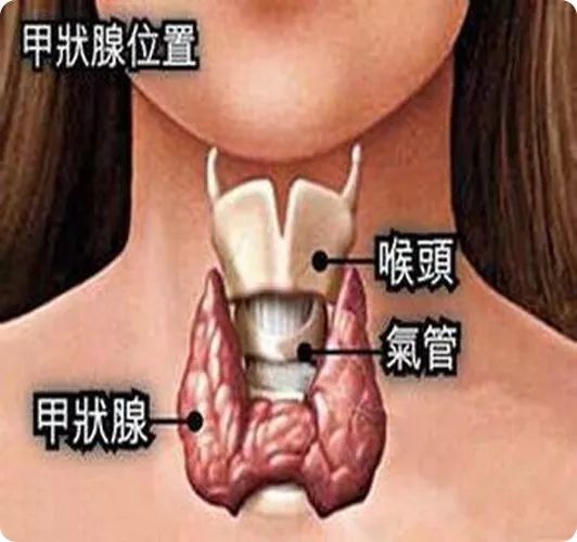 桥本甲状腺炎的症状及发病原因,桥本氏甲状腺炎冬季容易发病