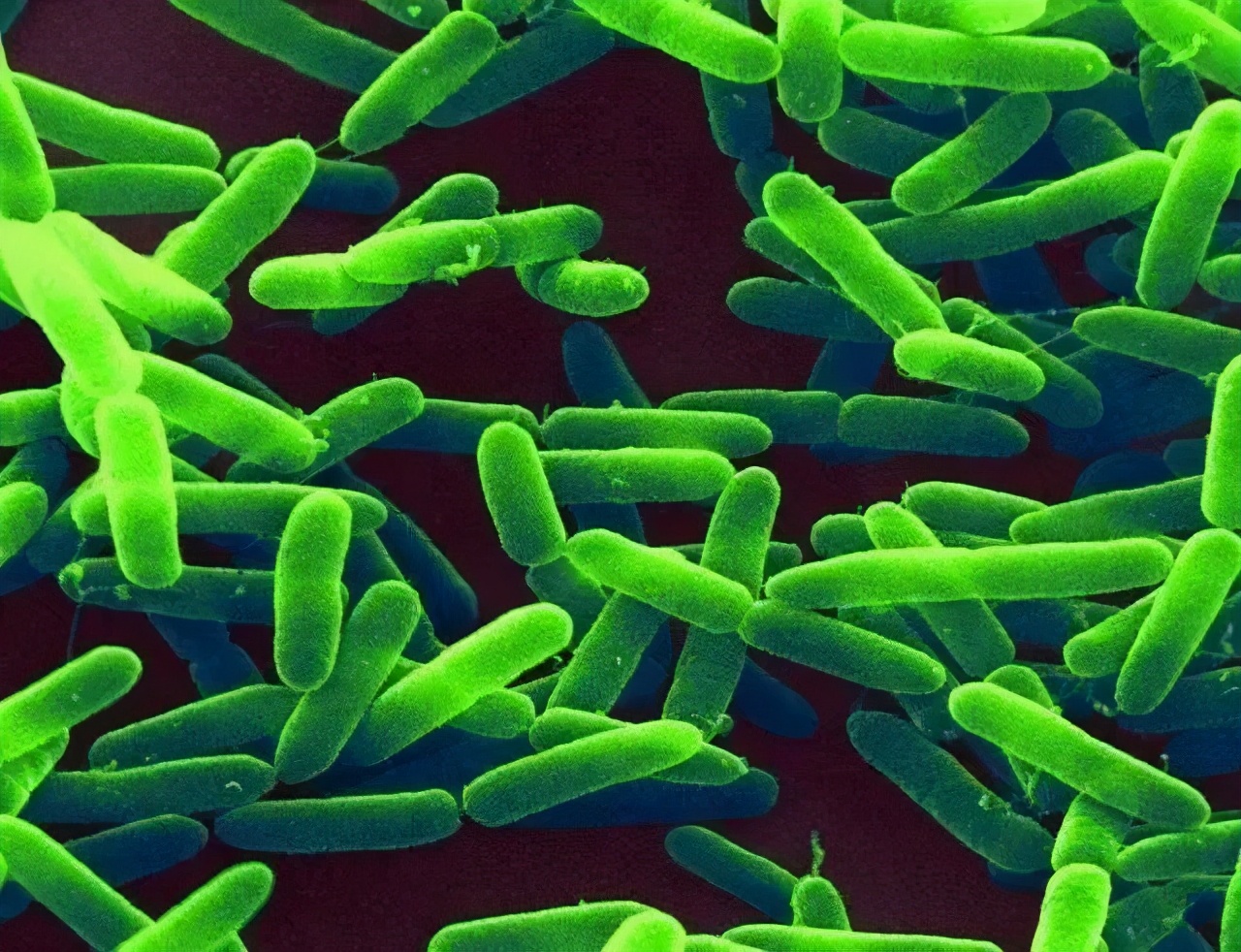 锦鲤掉鱼鳞该怎么治疗,锦鲤掉鱼鳞怎样才能治好