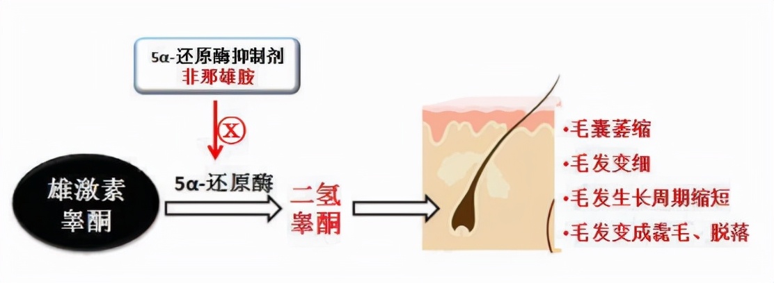 头发越来越少怎么补救,头发没掉但越来越少