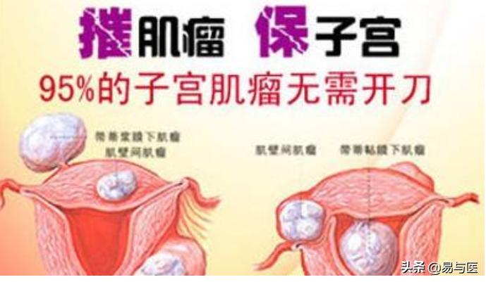 切除子宫就是没子宫了对吗,切除子宫就不会得宫颈癌吗