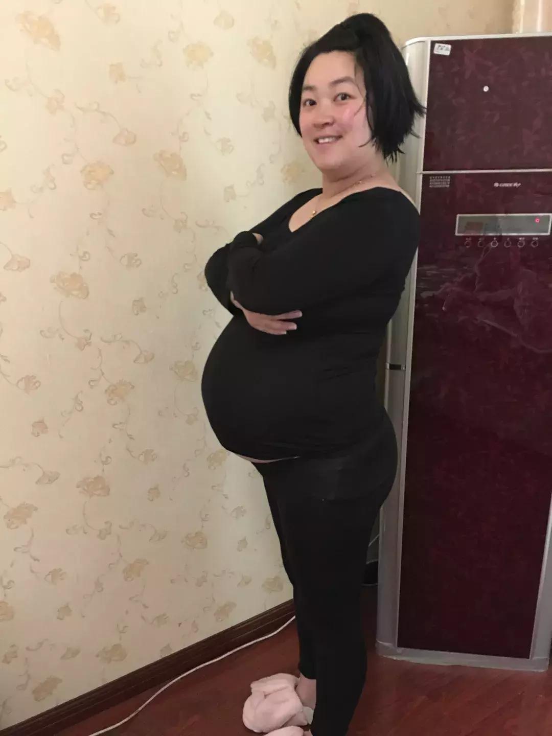 你生孩子的样子真丑,怀孕越来越丑是什么原因