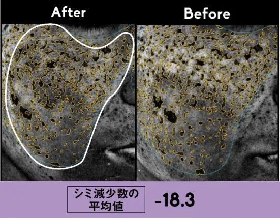 贵妇美白精华测评,不花冤枉钱国货推荐