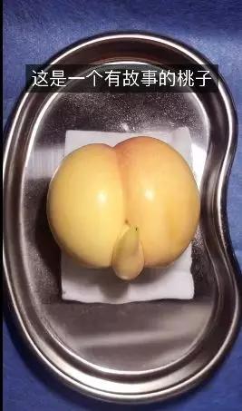 我在快手上看人切洋葱，竟然弄懂了剖腹产？